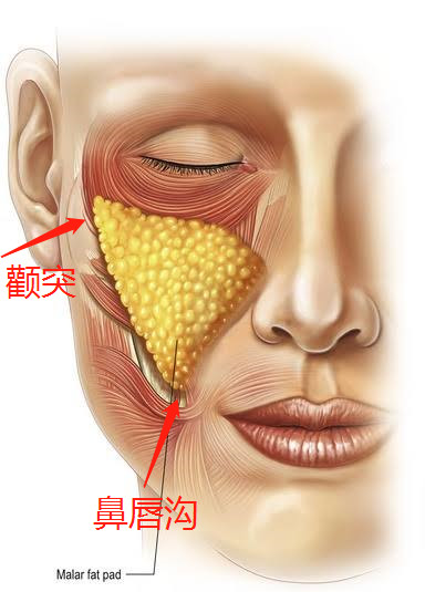 面部脂肪垫图片图片