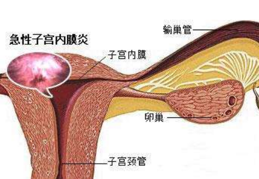 宫颈出现炎症