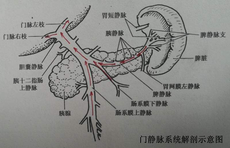 门奇静脉断流术图片