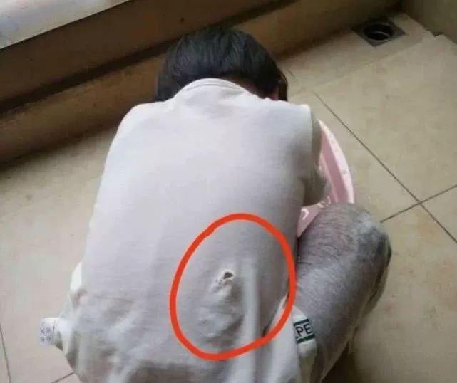 虎门2岁娃被咬伤,狗主的反应让人怒了