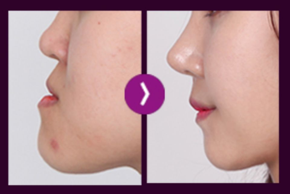 鞋拔子脸的她18岁怀孕辍学孕期被嫌弃出轨2年后完美复仇美到艳光四射