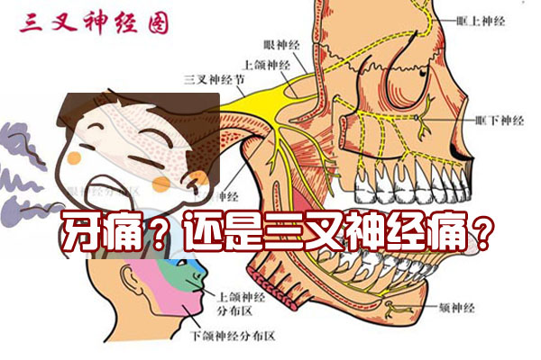 三叉神经痛反复发作疼痛难忍时切忌盲目乱治或拖延