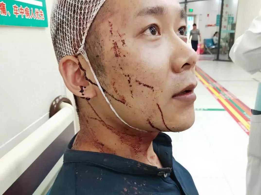 桂林众阳华城售楼部闹大了!现场有人头破血流!