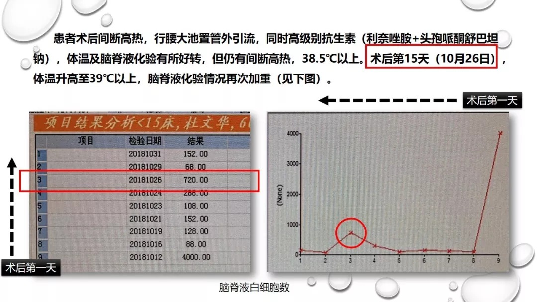 趙天智副教授前床突磨除與腦脊液漏處理中鼻道經篩入路解剖閱片與手術