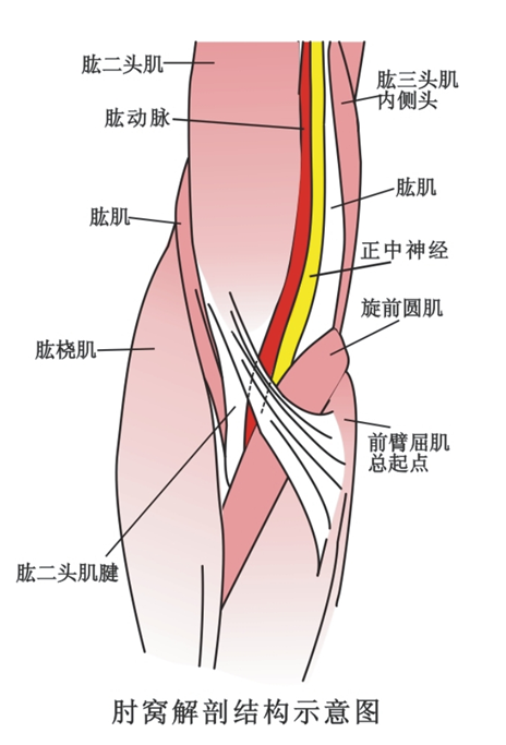 肘部筋膜炎 (原创)