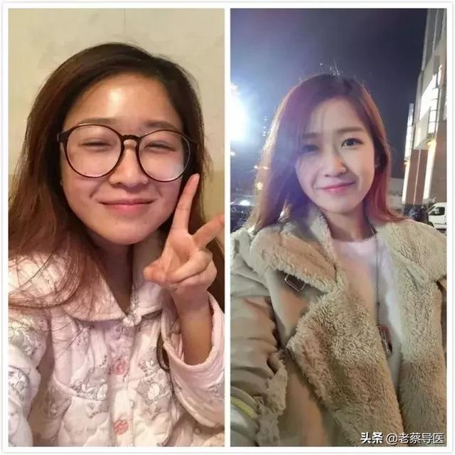 "五一"不放假!做全飞秒近视手术还打八折,最高省3600元