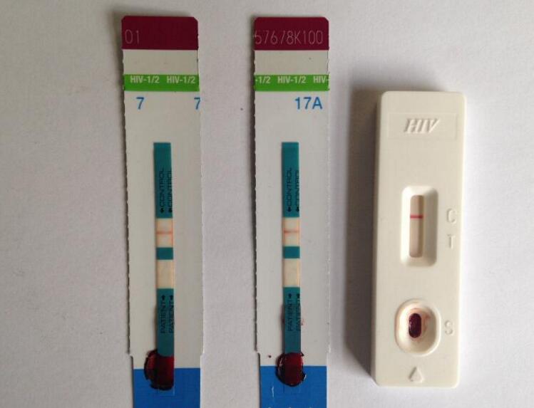 艾滋病感染後有哪些症狀hiv試紙可以檢測出來麼