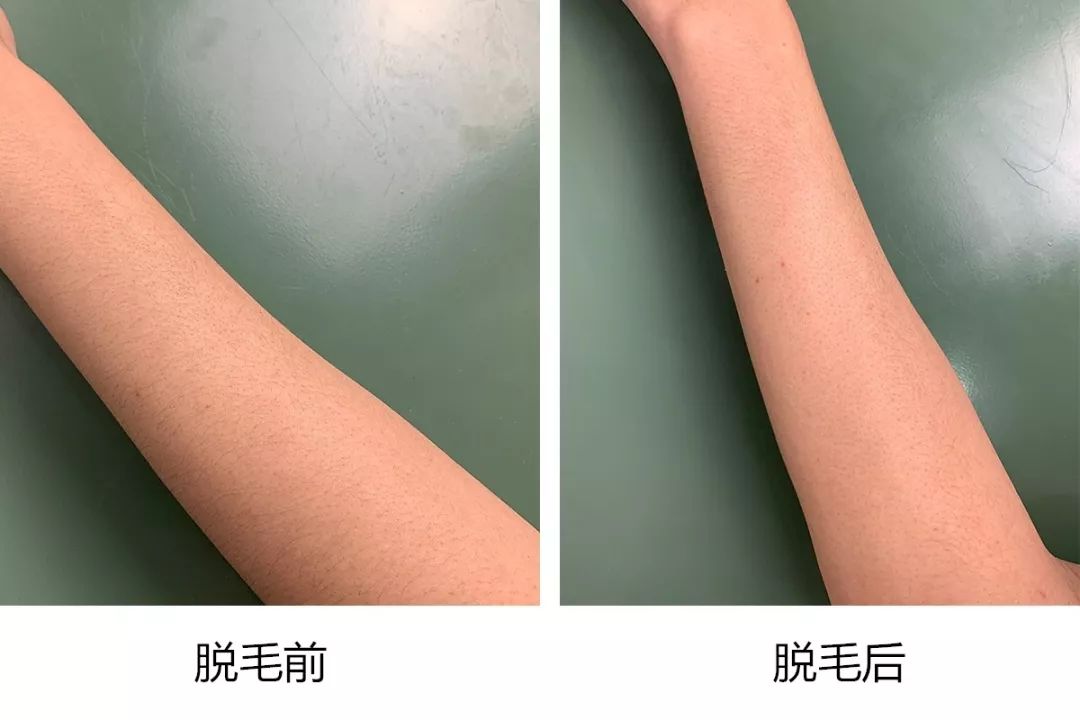 一定要有点耐心, 静置8~10分钟,然后用专用刮擦板擦拭脱毛效果较好
