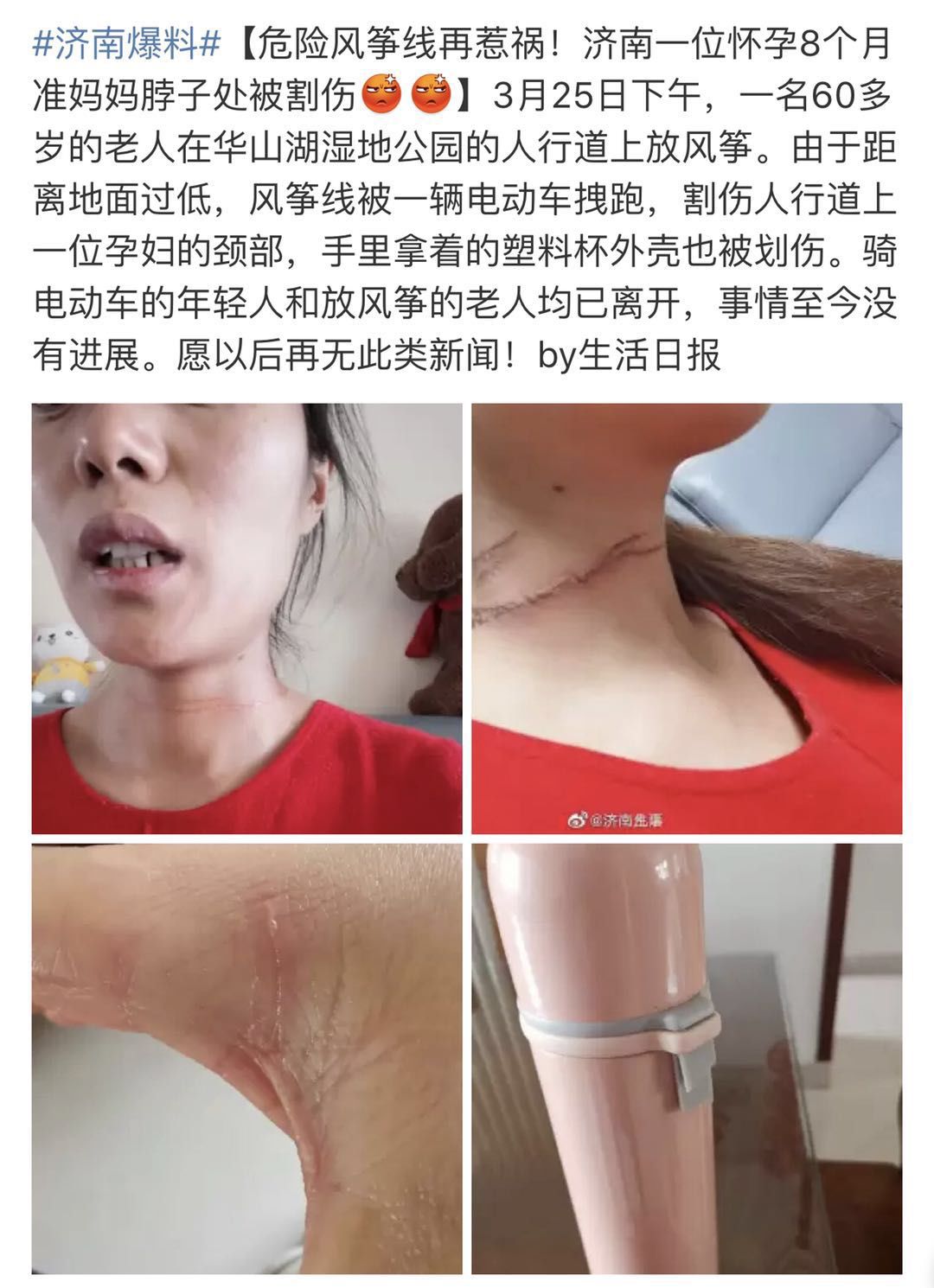 4岁女童被它割颈春季带孩子出门千万当心这三样