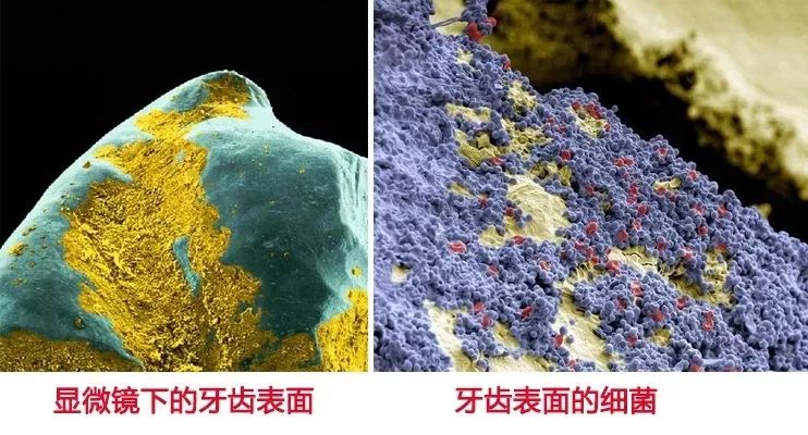 南宁人用这个刷牙,一整天都能拥有清新口气!