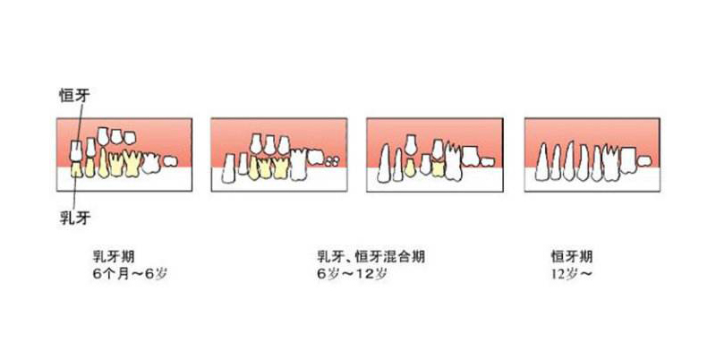 乳牙有齲齒是補還是拔