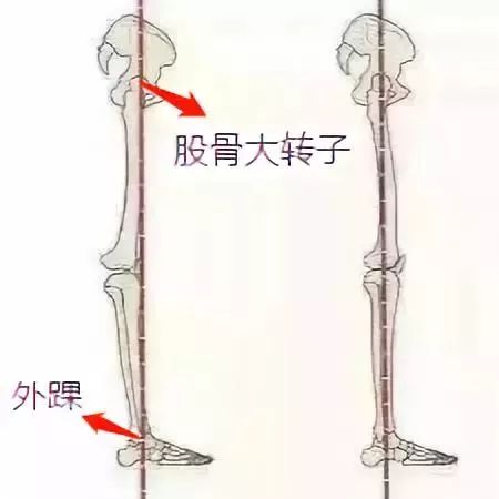 利用重垂線,一端固定在股骨大轉子,沿著重力垂下,另一端固定在外踝上