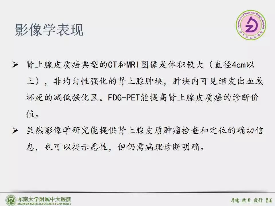 肾上腺皮质癌adrenalcorticalcarcinomaacc病例东南大学附属中大医院