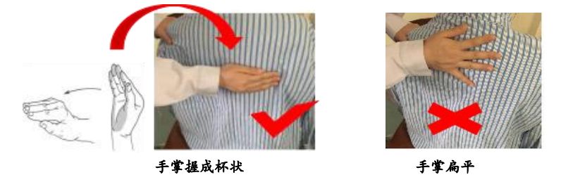 全方面详解叩击排痰法，小伙伴们赶紧收藏起来_患者