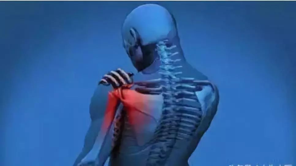 表现除感觉异常外可能还有麻木,疼痛,有些病人可表现为前胸部肩胛周围