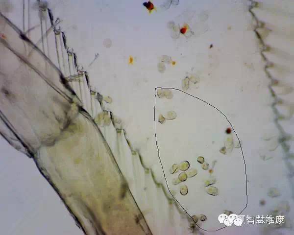 快速判断虾患病秘籍——高清图详解!