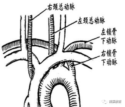 心脏及大血管位置异常丨相关概念及表现_大动脉