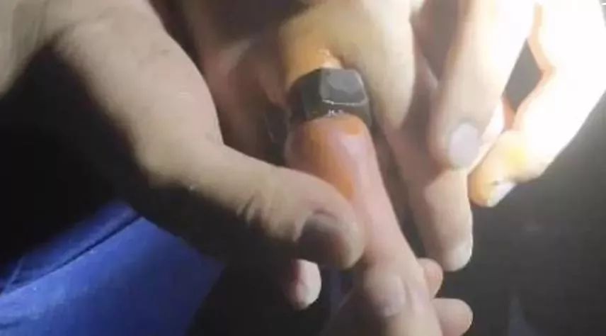 拿螺帽当戒指玩银川14岁男孩手指被套住30多小时68