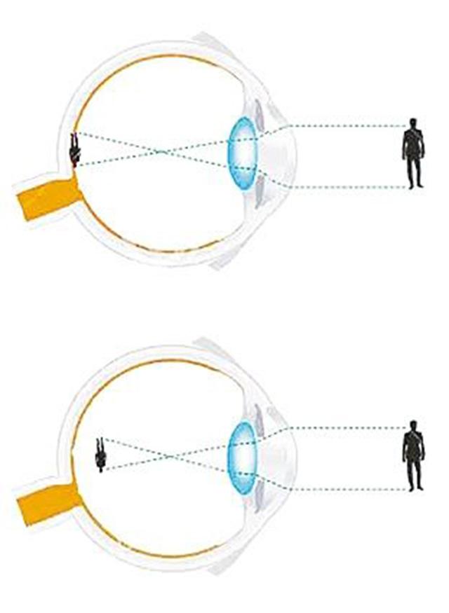 揭秘瞳孔在眼球中的作用_光線