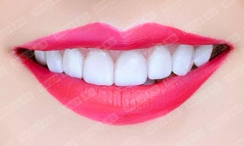 有一种牙齿缺损叫瓜子牙