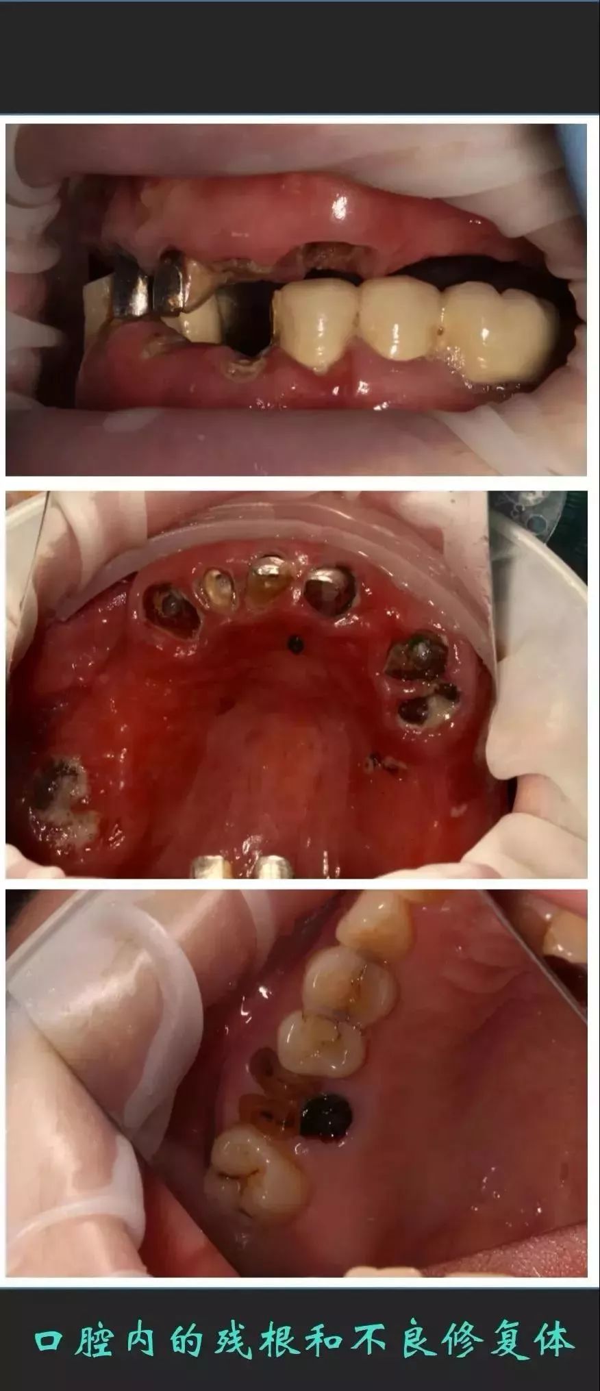 牙出血照片图片