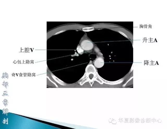 超全胸部ct读片解剖太实用了