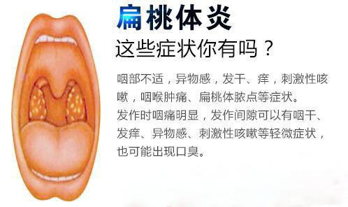 首大石萍扁桃体发炎能自愈吗