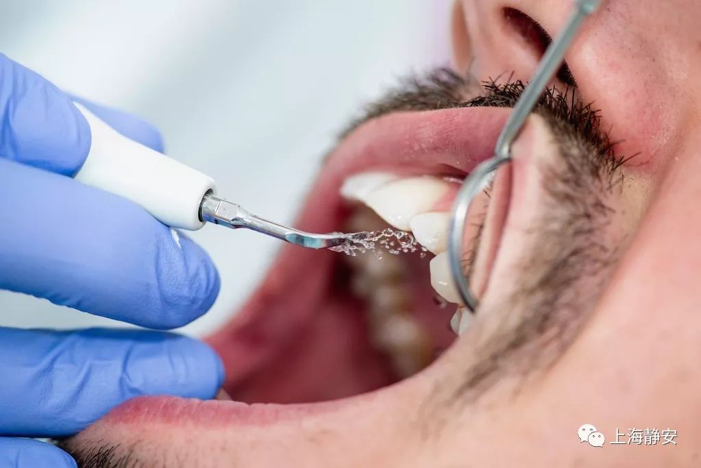 他洗个牙,把牙洗成了"梳子"!这锅究竟该谁来背?_牙齿