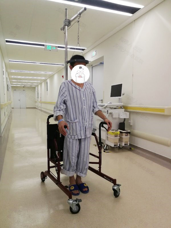 图片行动自如的脊柱侧弯halo头环牵引原创