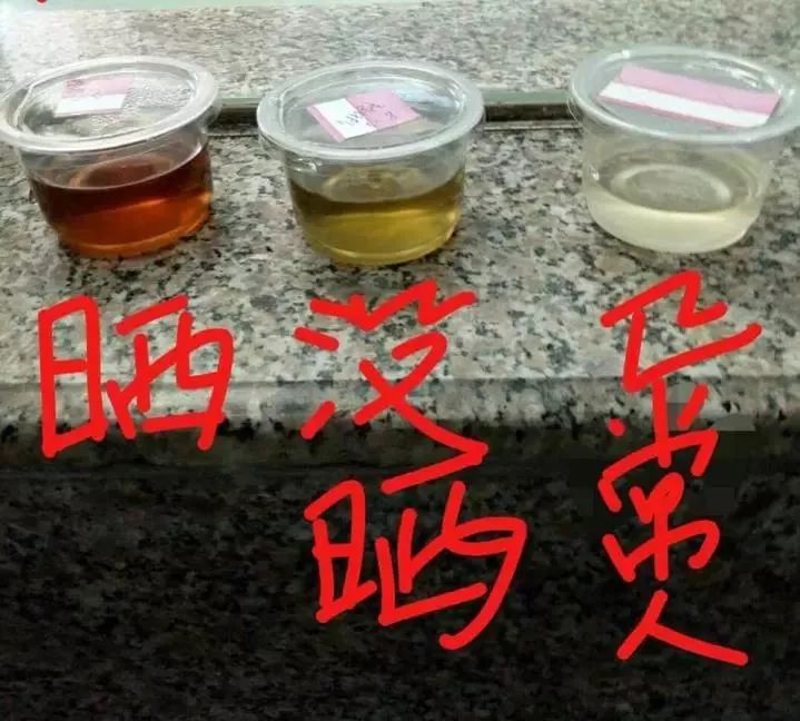 24岁护士怀孕后患吸血鬼症惧怕阳光曝晒尿液查出真相竟是父母当年做错