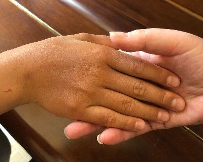 最美的手我们找到了