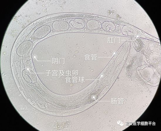 大家都冷静冷静,小编要开始科普了哈粪类圆线虫粪类圆线虫是一种肠道