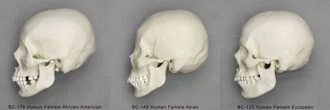 高加索女性头骨图片