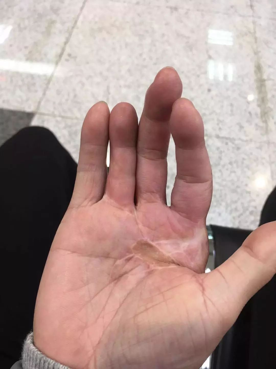 滴血的商品你没有了钱而我没有了手