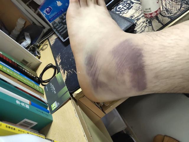 华中区学生跆拳道比赛武汉高校一学生负伤坚持比赛夺银