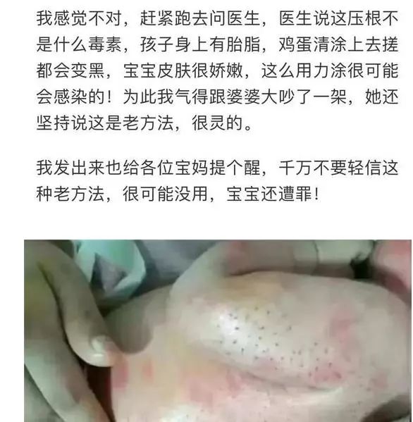 宝宝身上长满黑刺,婆媳育儿理念不同害惨娃!