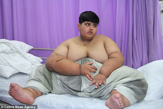 世界上最胖的小孩子,年仅10岁,体重接近400斤!