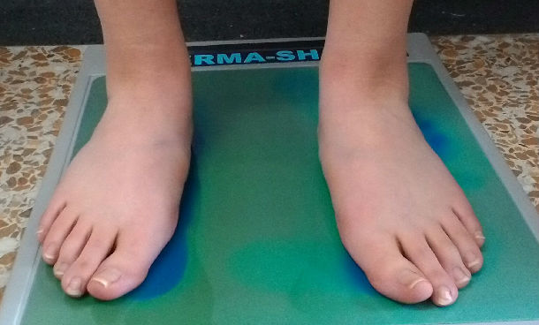 孩子走路老喊脚疼,妈妈应该引起重视,可能是"扁平足"引起的_儿童