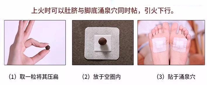 除了肚脐,还可以针对身体,脚底的多个穴位,哪里不舒服就贴哪里,全身都