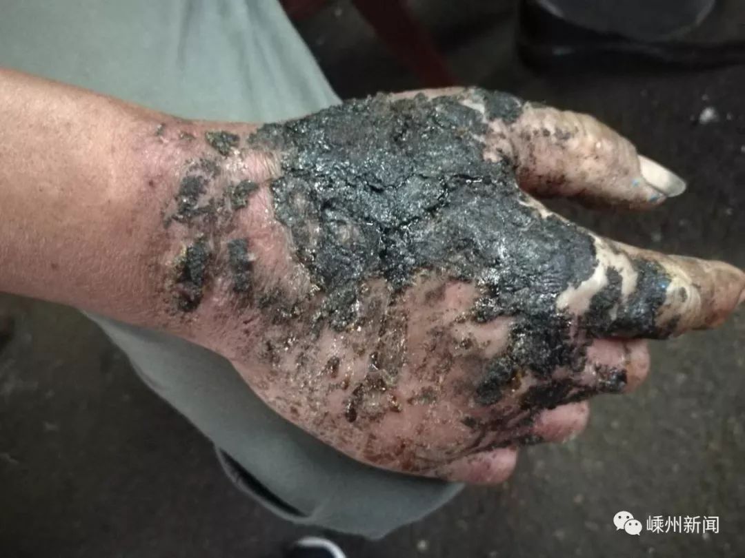 煤气罐着火随时可能爆炸这个嵊州大哥关键时刻徒手拖