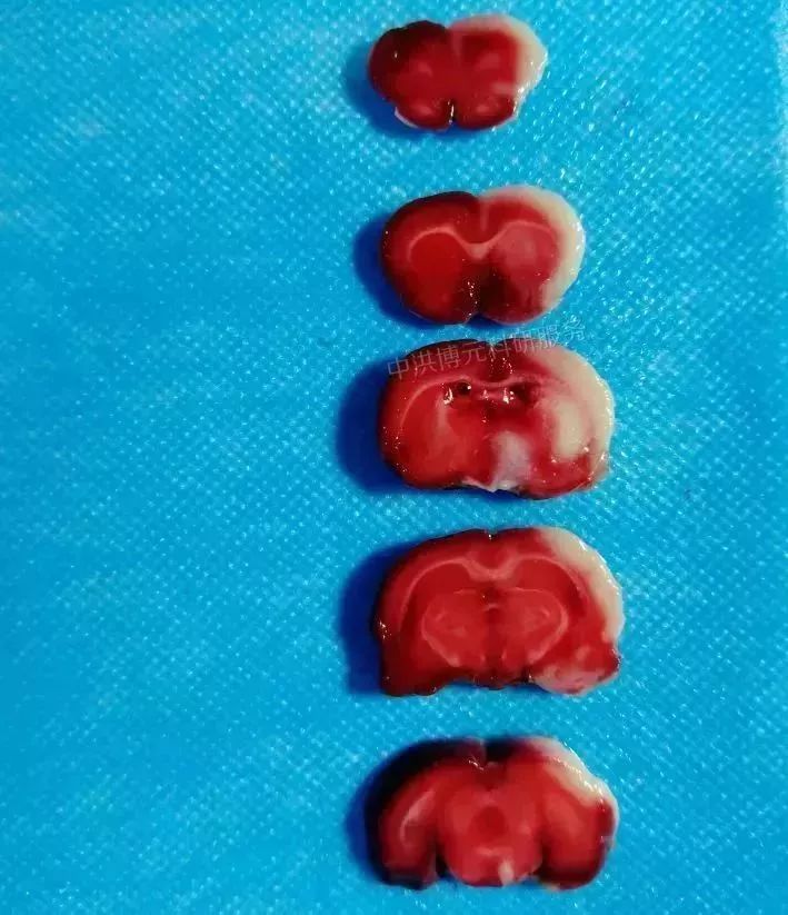 实验专栏丨小鼠腹腔注射我为什么总是打不进或出血