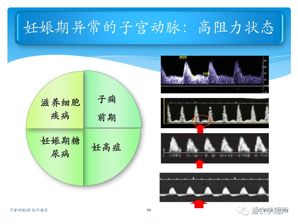 子宫动脉超声检查