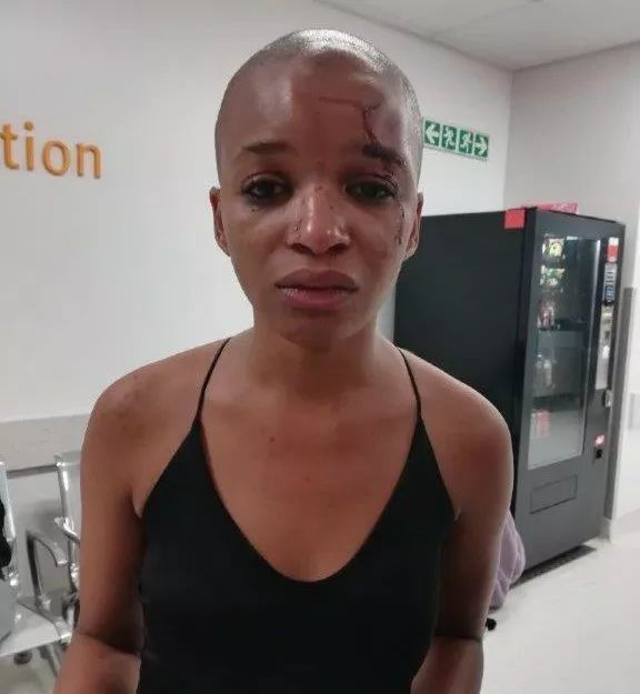 妙龄女大学生就被打鼻青脸肿,竟然是因为