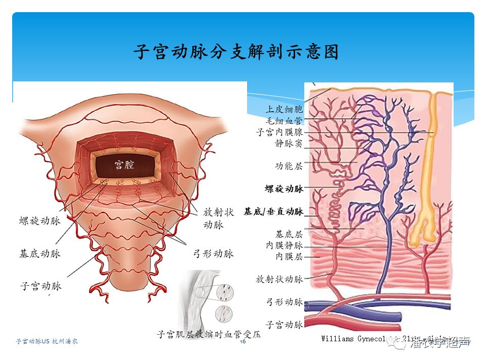 子宫动脉超声检查