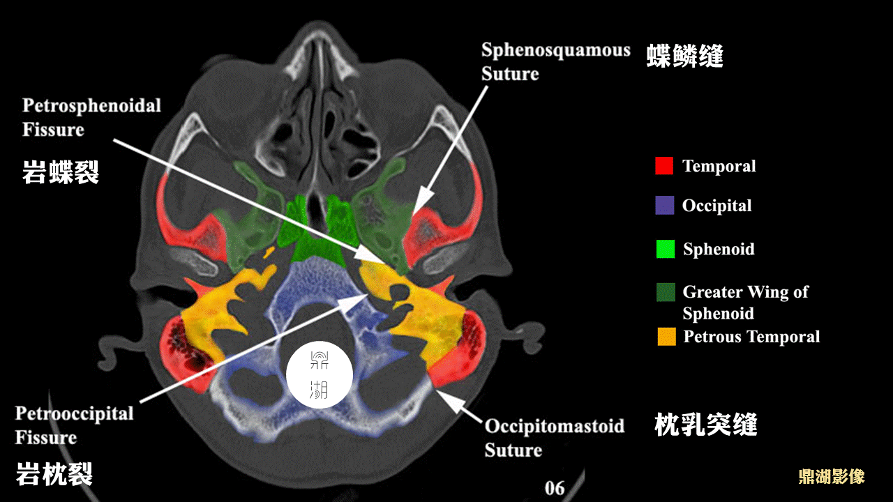 超精致颅底断层解剖(必点收藏)