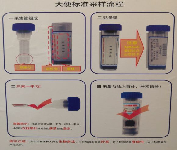 大便后,别忘了看一看,因为