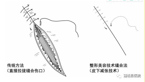 蒲城县医院五官科开展颌面部,耳廓美容缝合相关业务,每年为数百位患者