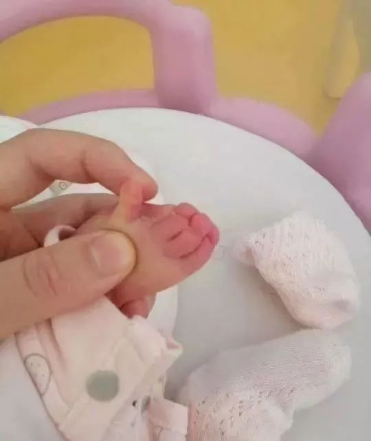 胎儿产检显示双手握拳,出生却没有右臂!医院承认过失