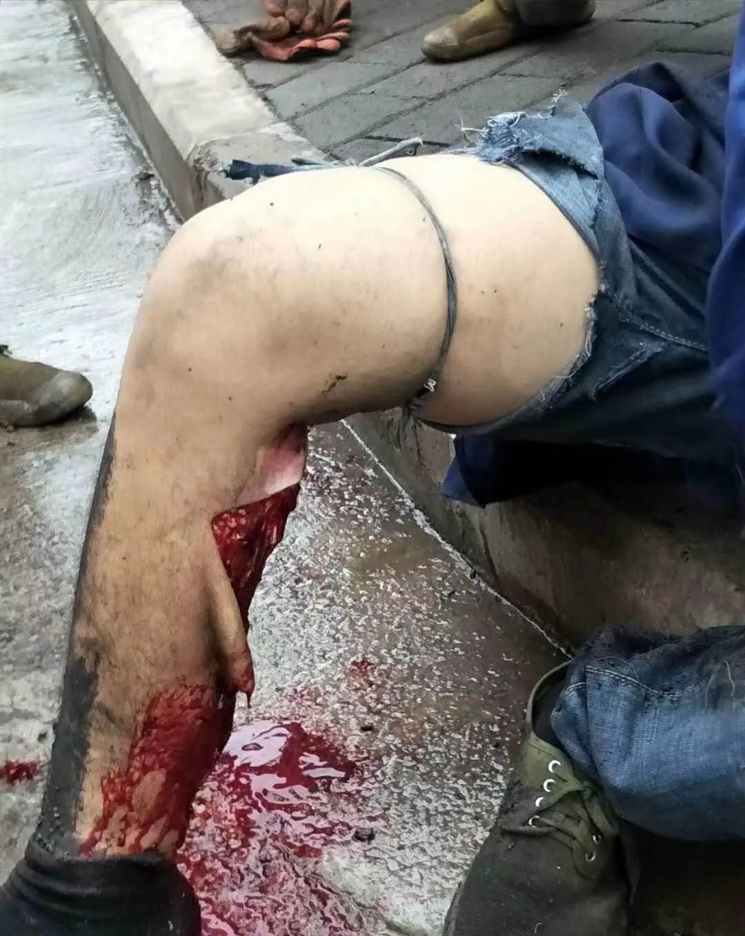 "离奇的钢筋吊装"伤害事故背后有无监管问题?_生产