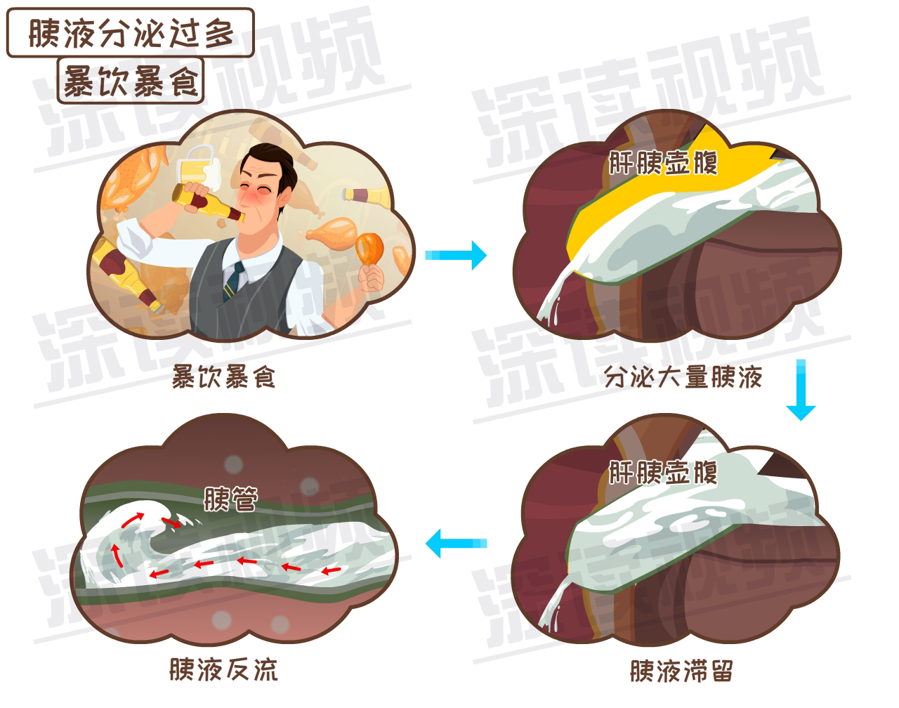 吃货必看这样吃喝竟会招来高致死率的胰腺炎预防大全